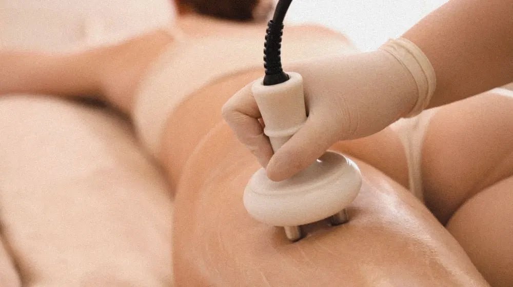 Cellulite loswerden: Was hilft wirklich, und was ist nur Hype? - Hormonic