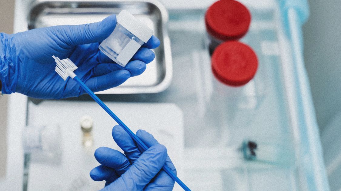 PAP-Test Ergebnisse verstehen: Pap I bis V erklärt - Hormonic